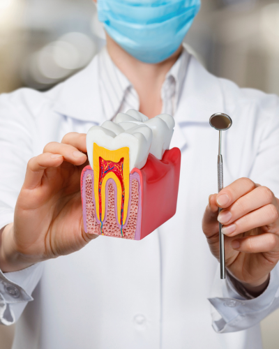 Root Canal